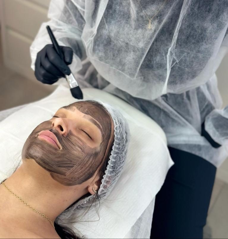 Aplicação da máscara de carbono no rosto para o peeling de Hollywood