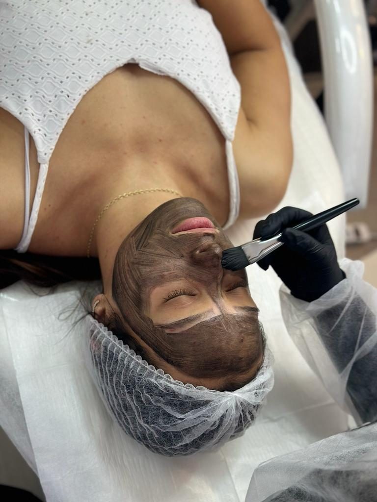 Aplicação da máscara de carbono no rosto para o peeling de Hollywood