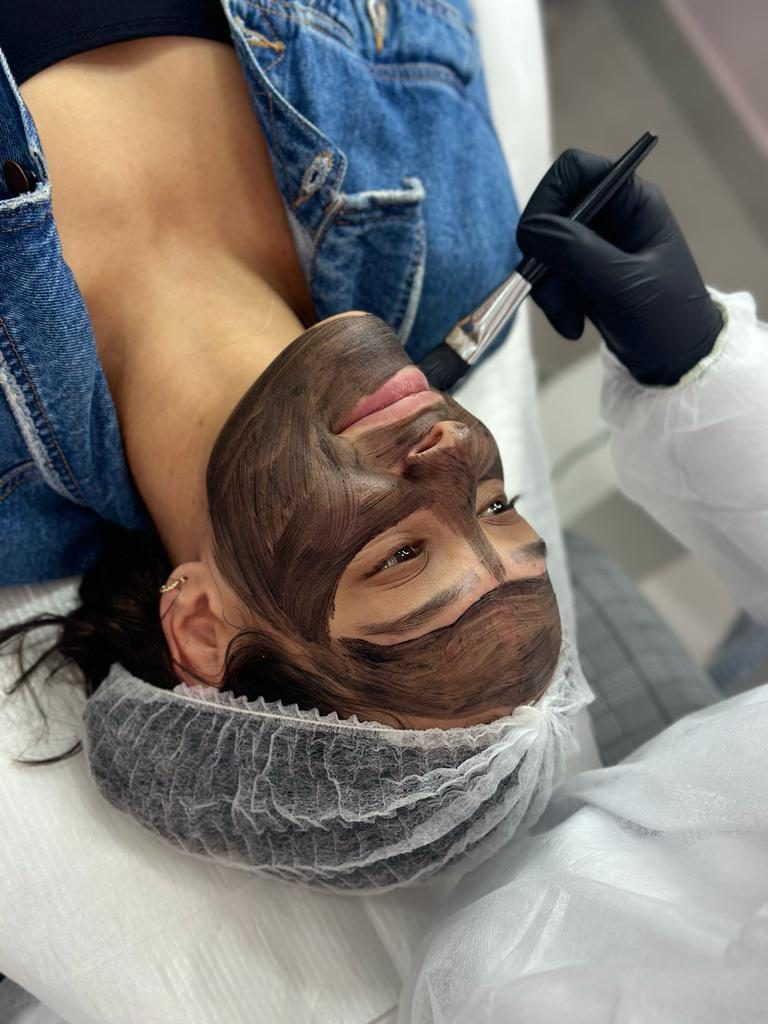 Aplicação da máscara de carbono no rosto para o peeling de Hollywood